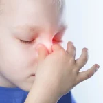 Đừng vội dùng Clorpheniramin cho trẻ khi bị sổ mũi ! Mẹ cần hiểu rõ điều này